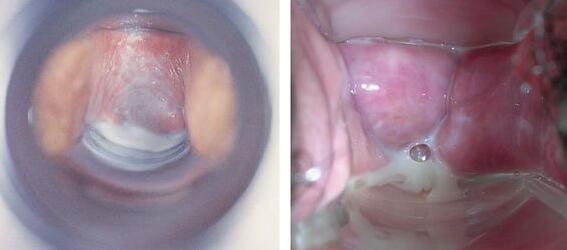 Клитор мен жыныс еріндерін тесу Майы бар анальный порно көру