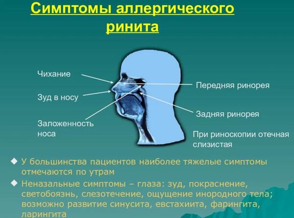 Чихание происходит при раздражении стенок